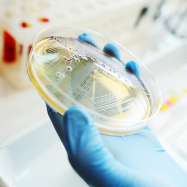 Petri-dish-784635523-low-res-1024x683